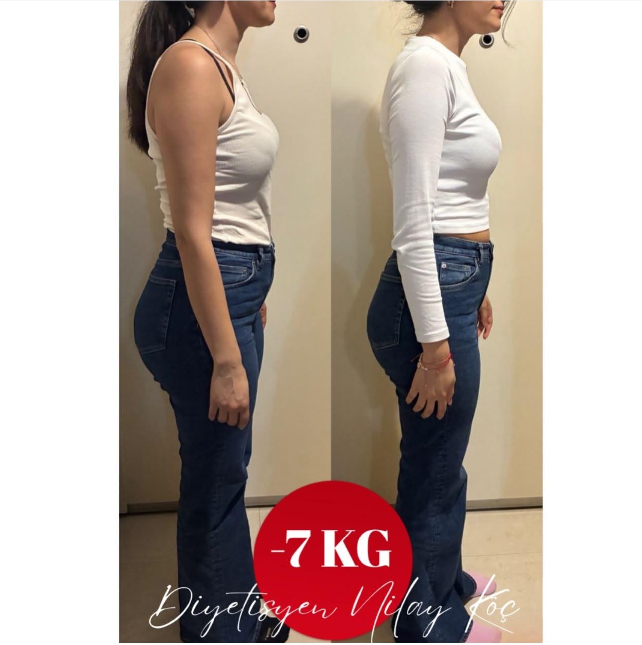Bir danışanın önce ve sonra fotoğrafları; görselde 7 kg kayıp belirtiliyor